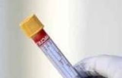 Regione Toscana Coronavirus: 120 nuovi positivi, nessun decesso, 86 guarigioni