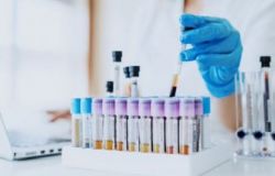 Regione Toscana Coronavirus: 755 nuovi casi, 144 guariti e due decessi