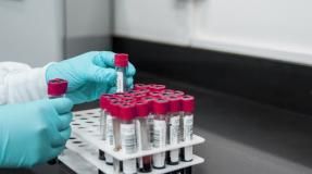 Toscana-Coronavirus, 444 nuovi casi, età media 43 anni, 15 decessi Toscana-Coronavirus, 444 nuovi casi, età media 43 anni, 15 decessi