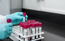 Toscana-Coronavirus, 444 nuovi casi, età media 43 anni, 15 decessi