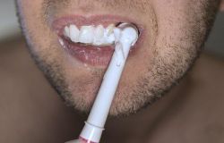 Municipio XII: odontoiatri nelle scuole per insegnare la salute orale