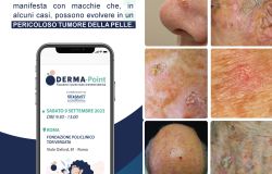 Tor Vergata, al via la campagna Derma Point: facciamo il punto sulla cheratosi attinica