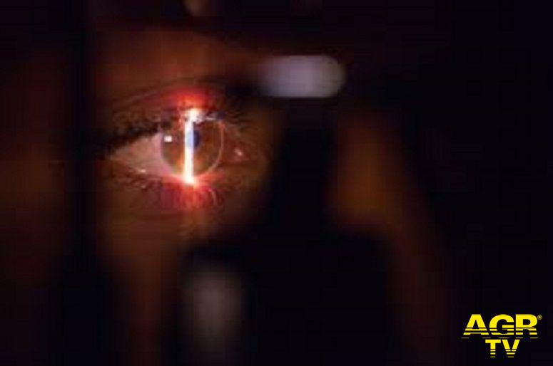 Implantable Collamer Lens Una soluzione efficace per la correzione permanente di un difetto visivo in crescita