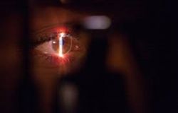 Dimenticare la miopia con le Implantable Collamer Lens