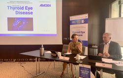 malattia oculare tiroidea 3 convegno motore sanità bologna