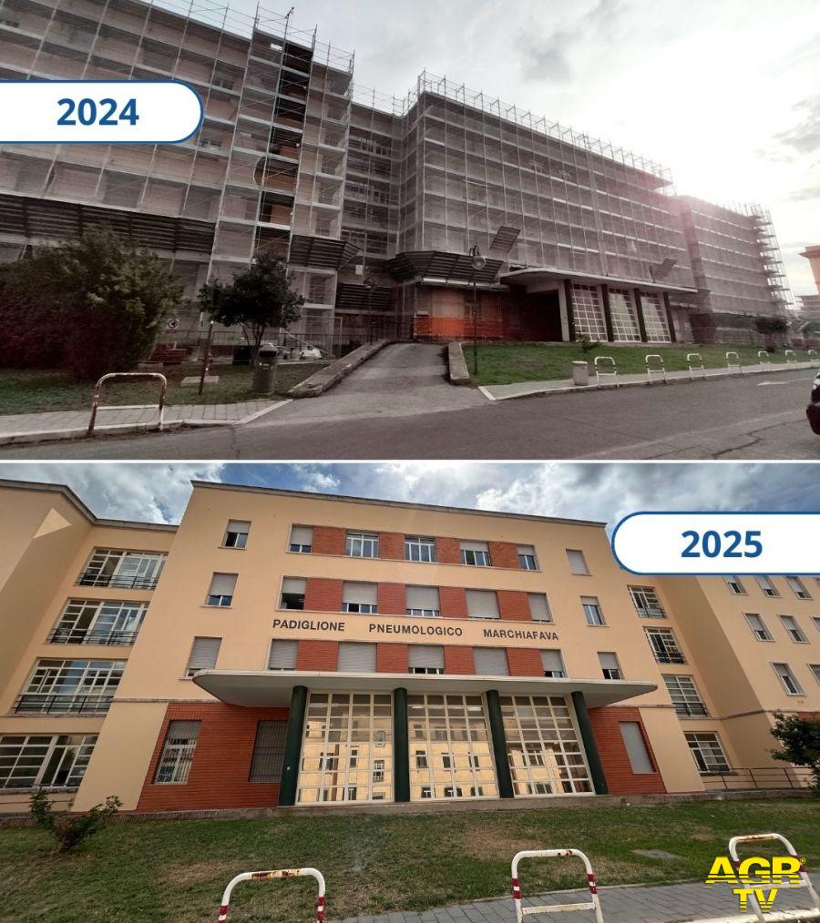 San Camillo un anno di lavori e nuovi investimenti 2024 - 2025