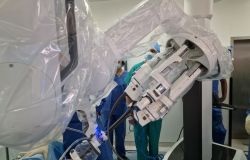 IRE, chirurgia toracica oncologica,guida l'era del robot Single Port, un solo foro per operare i pazienti più fragili