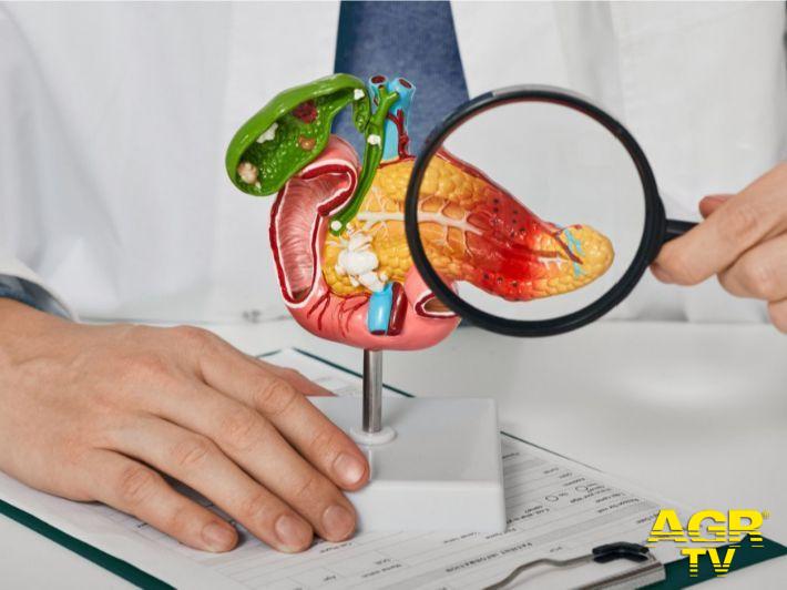 cancro pancreas- AIGO foto immagine da comunicato stampa