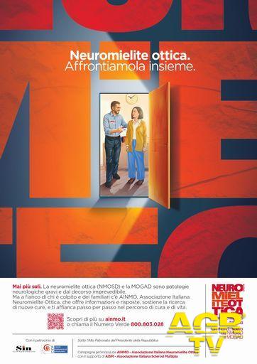 Neuromielite ottica locandina Neuromielite ottica locandina