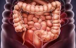 Sanità, tumore del colon in aumento tra i giovani, in Italia oltre 50 mila casi