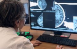 Roma, San Camillo-Forlanini, mammografia con IA integrata al servizio della diagnosi senologica
