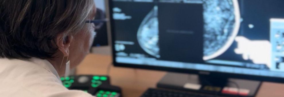 Roma, San Camillo-Forlanini, mammografia con IA integrata al servizio della diagnosi senologica
