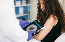Melanoma day, MedEA lancia l'allarme: una diagnosi su tre riguarda i nei