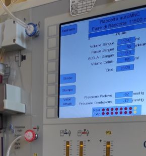 Roma. Medicina d’avanguardia al San Camillo Forlanini: arriva la terapia CAR-T contro i tumori del sangue