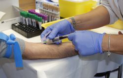 AIL, tumori del sangue, ogni anno 30mila nuove diagnosi, oltre 2100 sono minori