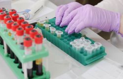 Londra, Eshre 42 annual meeting, la procreazione medicalmente assistita è cambiata, il fattore tempo resta decisivo