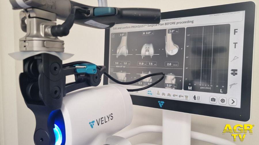L’INI Grottaferrata ha installato VELYS, innovativo sistema robotico dedicato agli interventi di protesi totale e parziale del ginocchio - © Foto da comunicato Stampa INI L’INI Grottaferrata ha installato VELYS, innovativo sistema robotico dedicato agli interventi di protesi totale e parziale del ginocchio - © Foto da comunicato Stampa INI