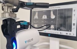 L’INI Grottaferrata ha installato VELYS, innovativo sistema robotico dedicato agli interventi di protesi totale e parziale del ginocchio  - © Foto da comunicato Stampa INI