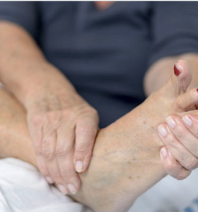 Gambe gonfie in estate: Perche' l'aggiunta del diuretico spesso  non serve