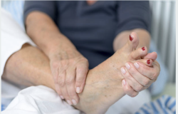 Gambe gonfie in estate: Perche' l'aggiunta del diuretico spesso  non serve