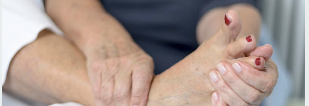 Gambe gonfie in estate: Perche' l'aggiunta del diuretico spesso non serve Gambe gonfie in estate: Perche' l'aggiunta del diuretico spesso non serve