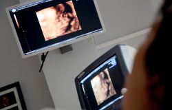 I Ginecologi universitari dedicano la prima giornata nazionale all'Endometriosi