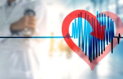Fibrillazione atriale, oltre un milione di anziani colpiti in Italia, cardiologi e medici di famiglia fanno rete