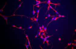 Le cellule staminali neurali sono responsabili della produzione di nuovi neuroni nel cervello adulto