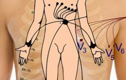Roma, prevenzione e malattie cardiovascolari